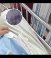308激光治白斑副作用大吗视频