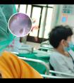 希格玛308光疗仪怎么看强度
